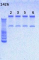 Thumbnail for version as of 15:20, 11 March 2013