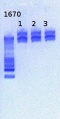 Thumbnail for version as of 17:21, 28 February 2013