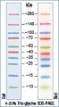 Thumbnail for version as of 01:04, 21 April 2016