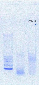 BetaActin PCR.JPG